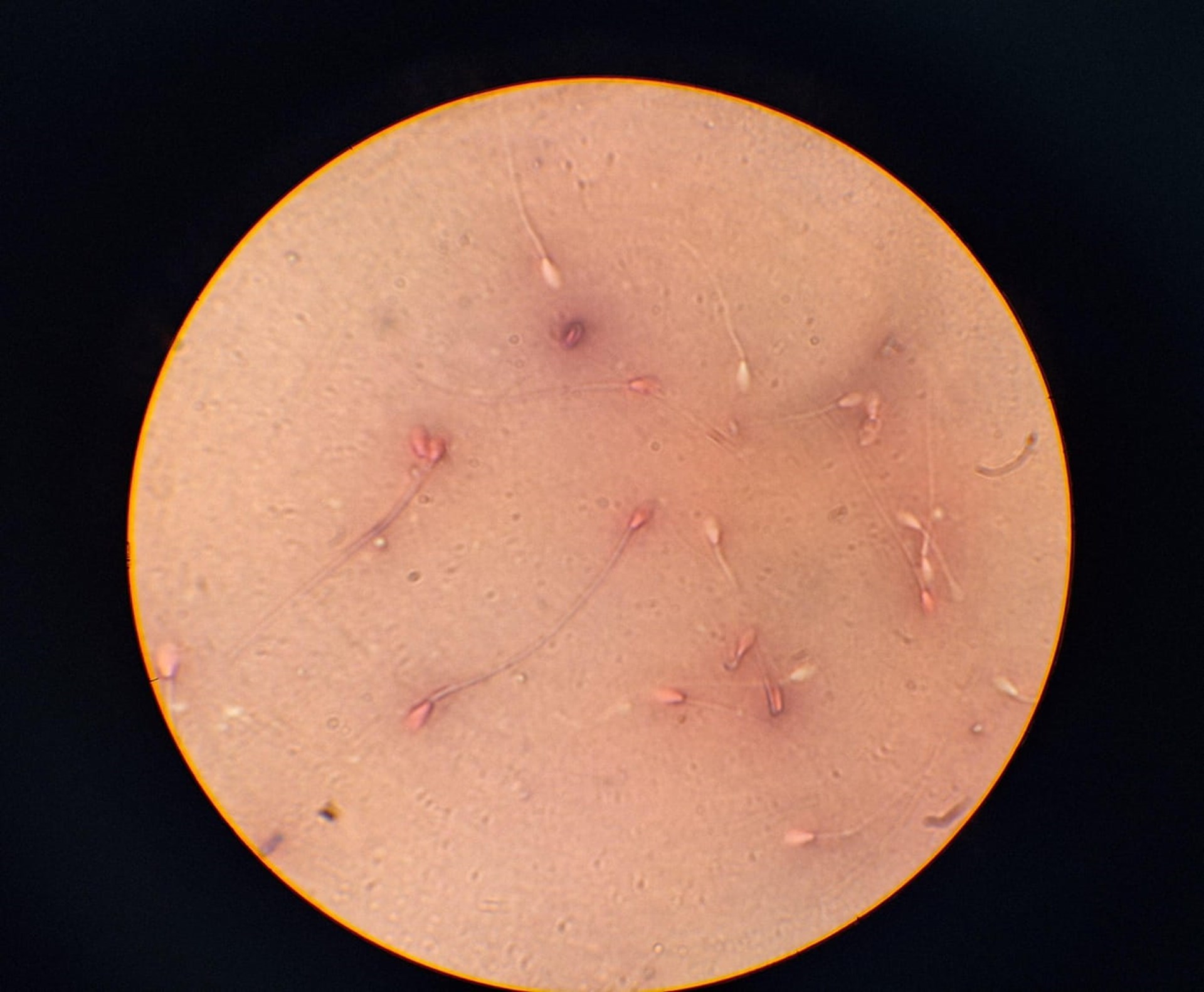 02_Congelacion_de_Semen_Reproduccion_Equino_Rancho_Santa_Rosa_Web_2025